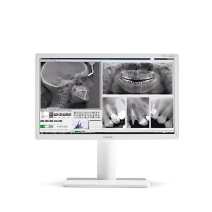 Intraoralinės kameros ir monitoriai